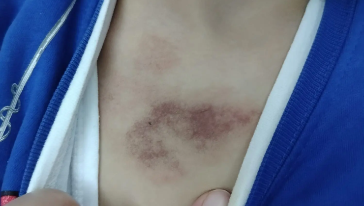 İBB kreşinde çocuğa şiddet ve istismar iddiası. Bakanlık açıklama yaptı