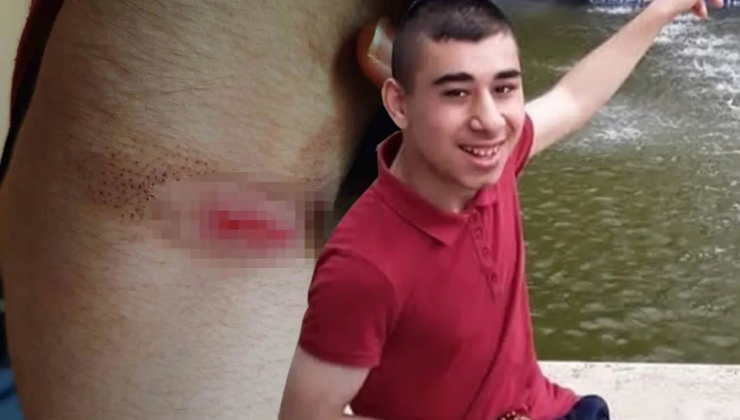 Bakımevinde ölüm davası. Engelli gence 30 kat fazla sakinleştirici verilmiş