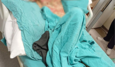 Gaziosmanpaşa'da duyma ve konuşma engeli bulunan kişinin telefonunu gasp eden ve benzin dökerek yakan sanığa 18 yıl hapis cezası