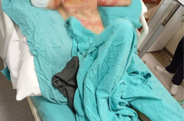 Gaziosmanpaşa'da duyma ve konuşma engeli bulunan kişinin telefonunu gasp eden ve benzin dökerek yakan sanığa 18 yıl hapis cezası